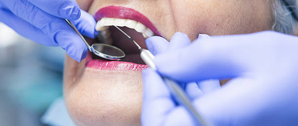 Best Emergency Broken Tooth Repair in Mclean, TX